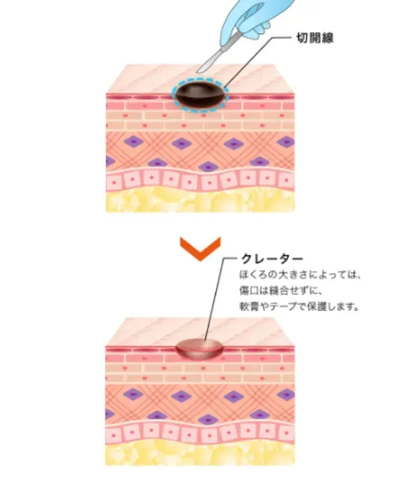 くり抜き法のイメージ画像