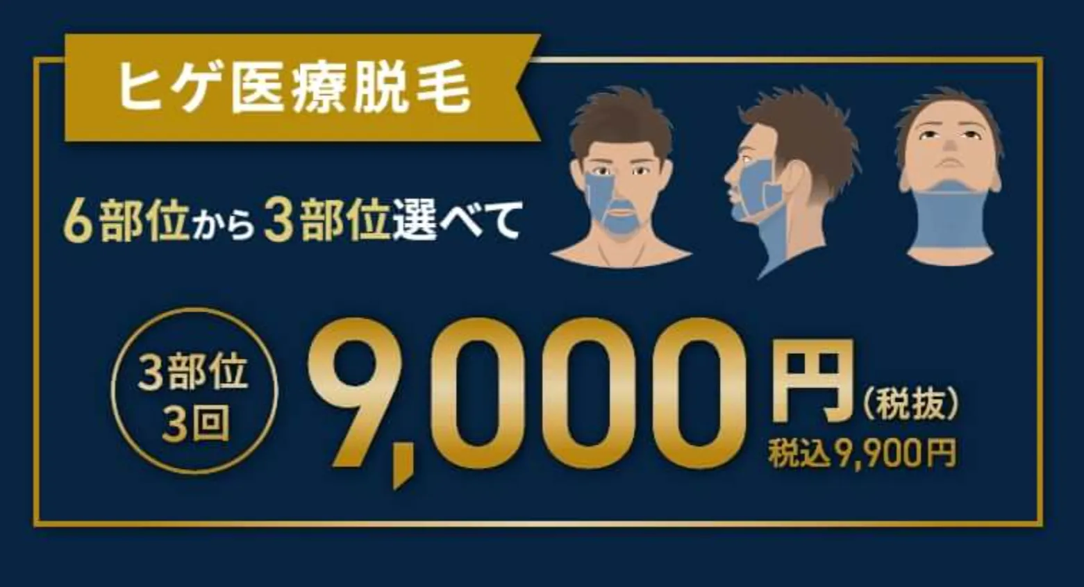 おすすめのメンズ医療脱毛