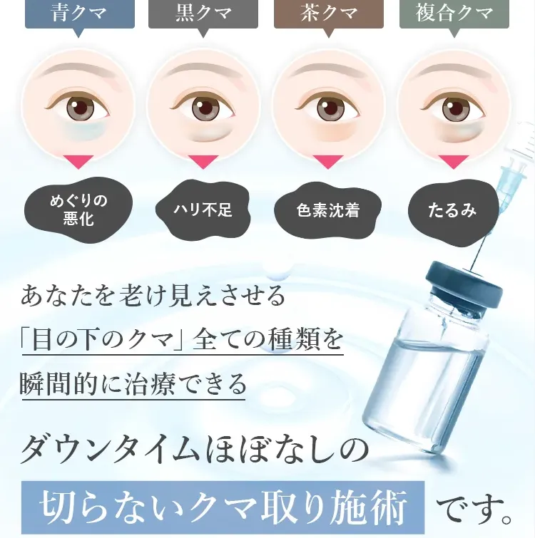 クマの種類について