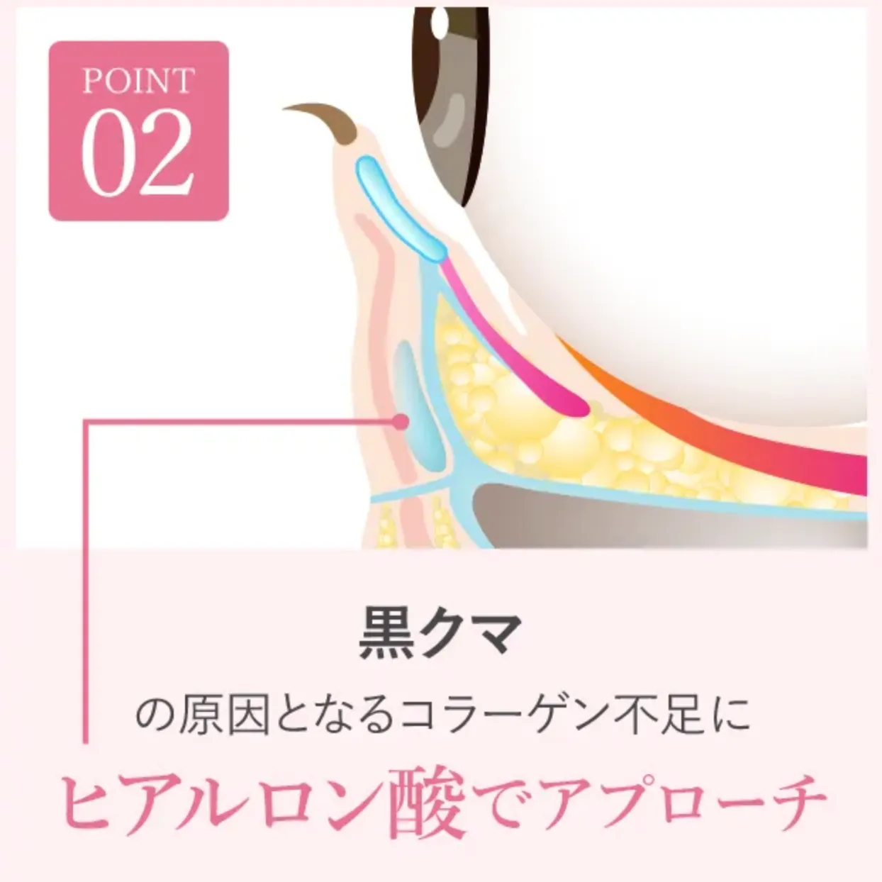 TCBの黒クマへのアプローチ