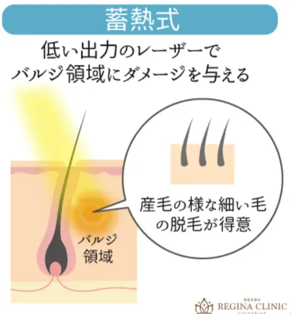 日暮里で都度払い医療脱毛が安いレジーナクリニックによる蓄熱式解説図