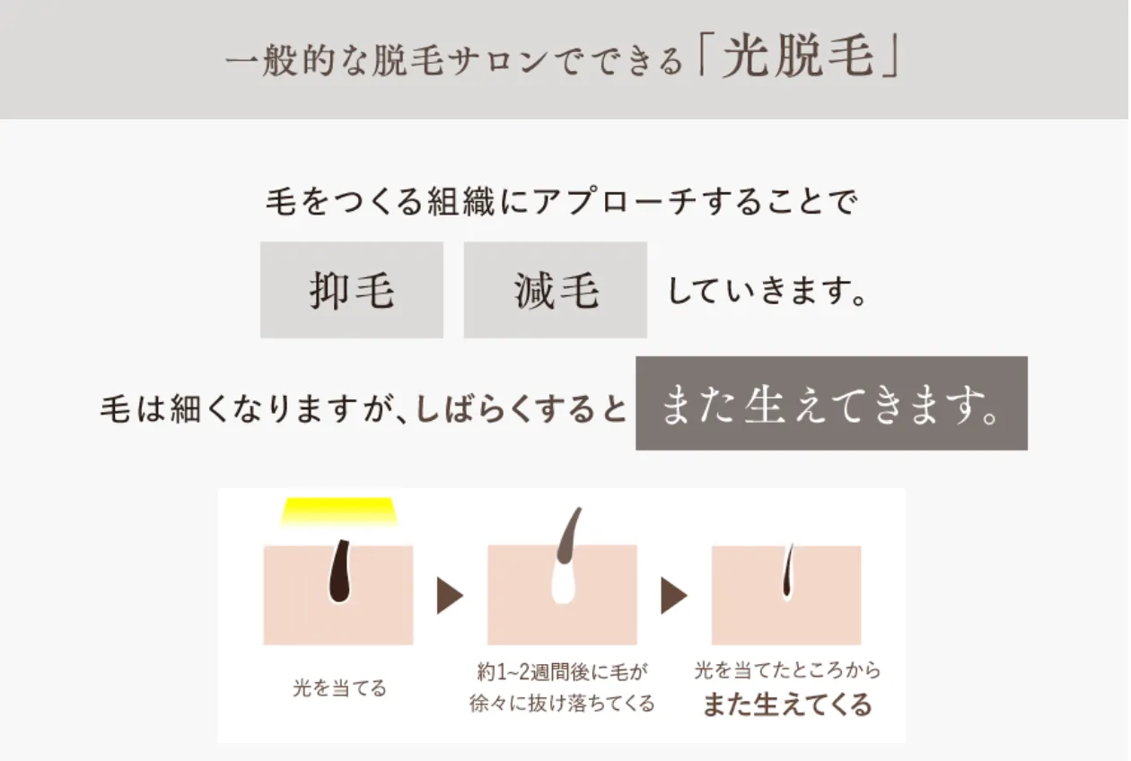 一般的な光脱毛の効果