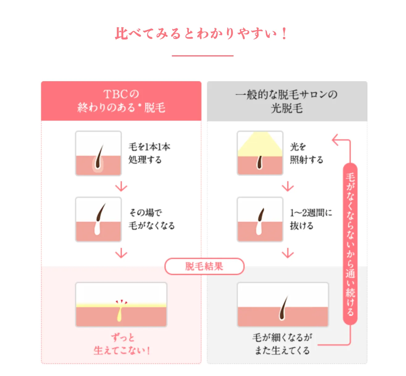 TBCの終わりのある脱毛と光脱毛の違い