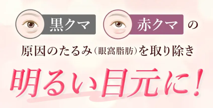 TCBのクマ取り案内