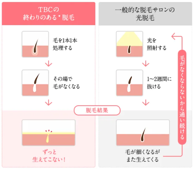 仙台でおすすめの脱毛サロン　エステティックTBCスーパー脱毛