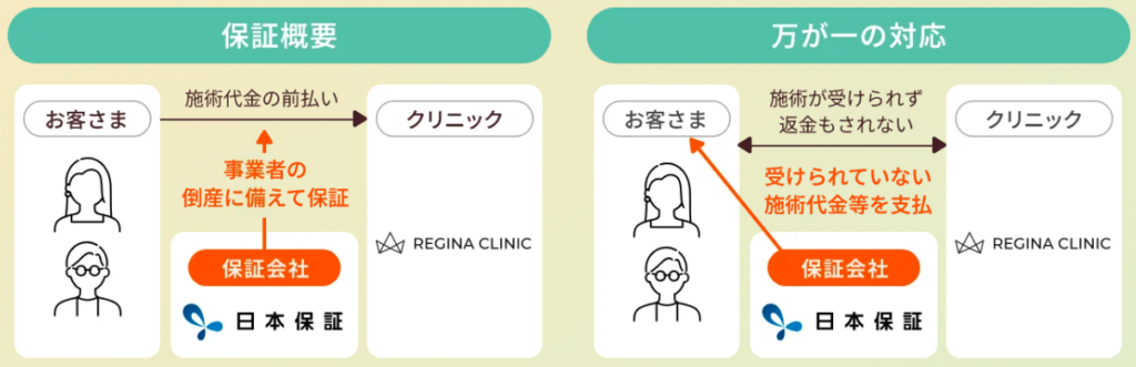 レジーナクリニックの前払金保証制度