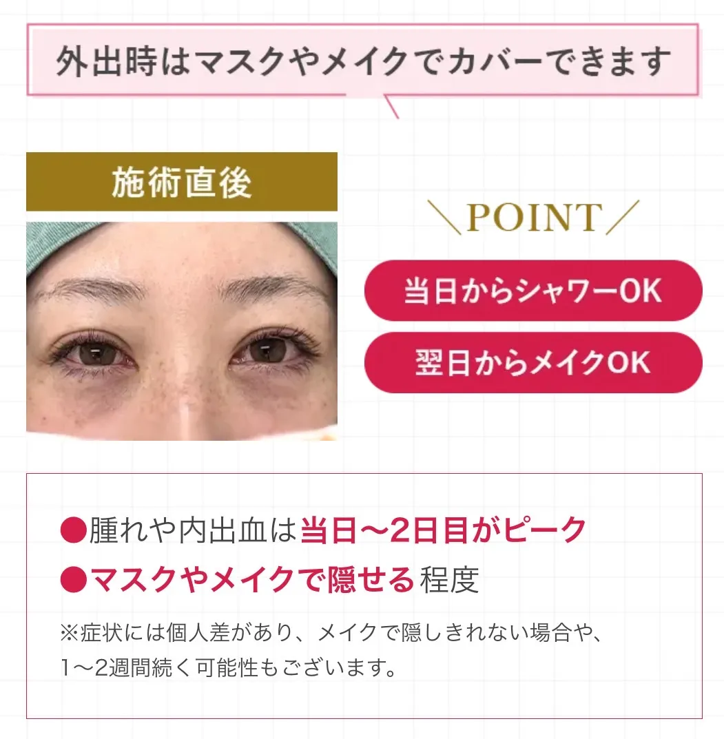 TCB術後の様子