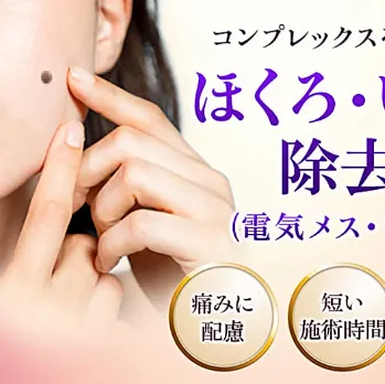 品川美容外科のほくろ除去のイメージ