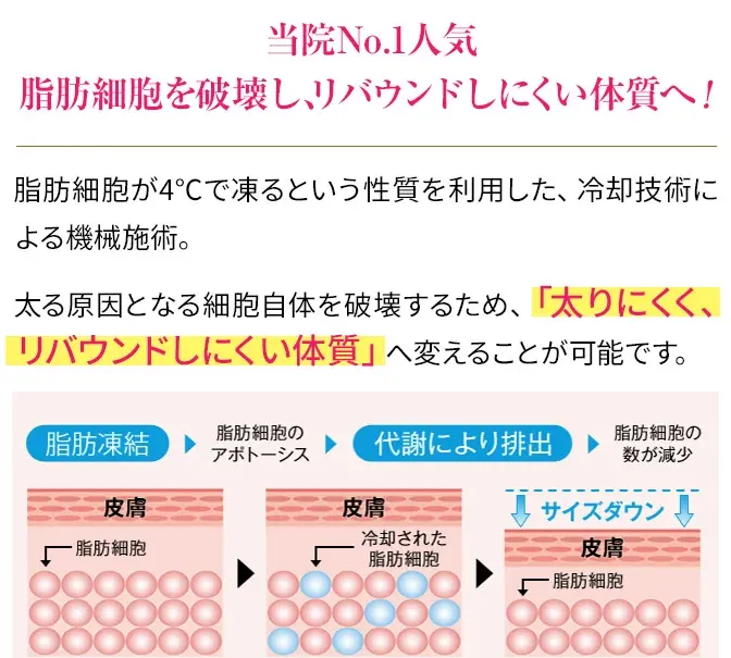 夏食べても痩せる方法があるって本当?専門家が徹底解説【管理栄養士監修】|脂肪冷却装置が痩せる仕組み