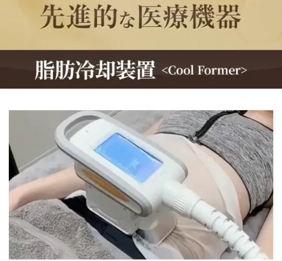 夏太り対策!むくみ・水太りに対するコーヒーでのダイエット法も解説【管理栄養士監修】|脂肪冷却装置の画像