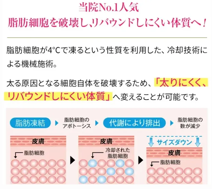 夏太り対策!むくみ・水太りに対するコーヒーでのダイエット法も解説【管理栄養士監修】|脂肪冷却装置の作用機序