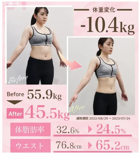夏太り対策!むくみ・水太りに対するコーヒーでのダイエット法も解説【管理栄養士監修】|実際に施術した方の画像