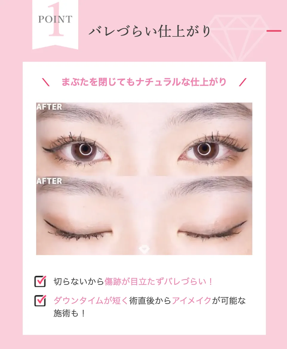 立川で二重整形がおすすめのクリニック TCBの症例写真