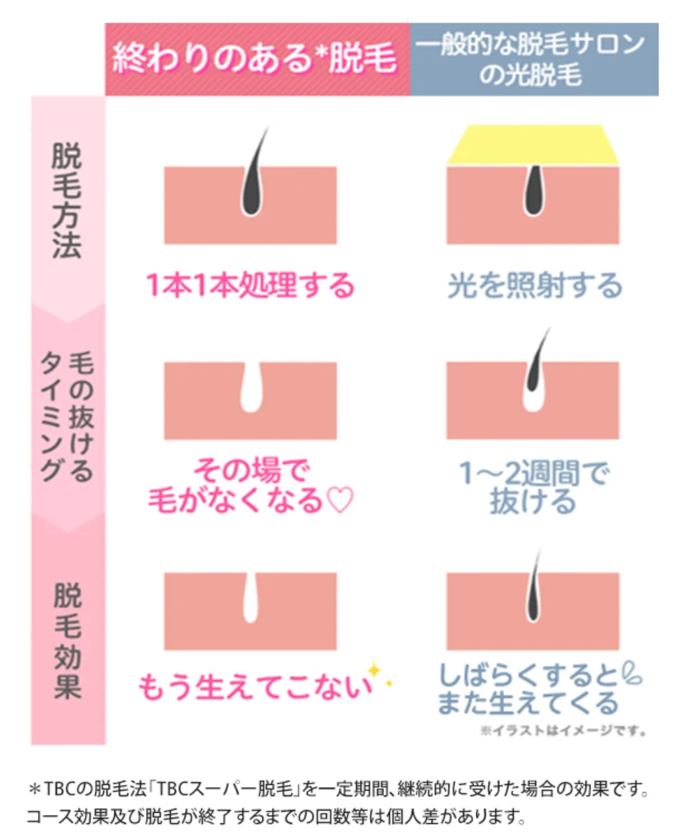 エステティックTBCのスーパー脱毛とほかのサロンとの脱毛方法の違い