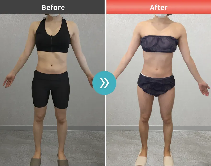 URARAクリニックの医療ダイエットに症例