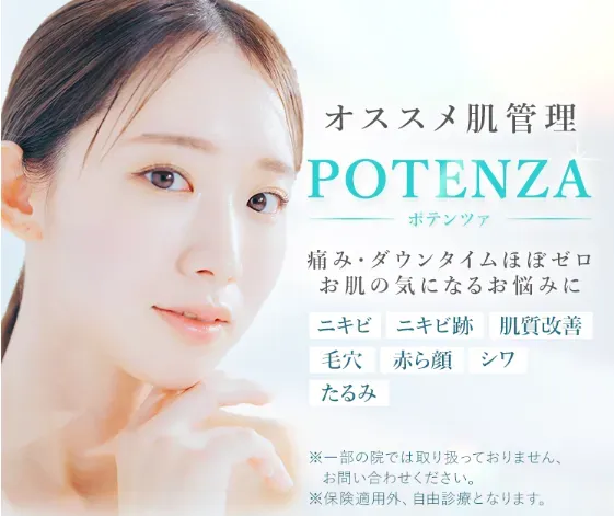 TCBのポテンツァ