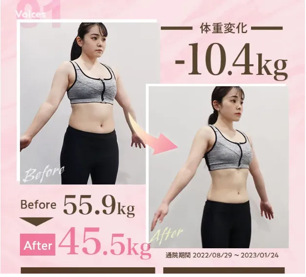 ディオクリニックの医療ダイエット症例