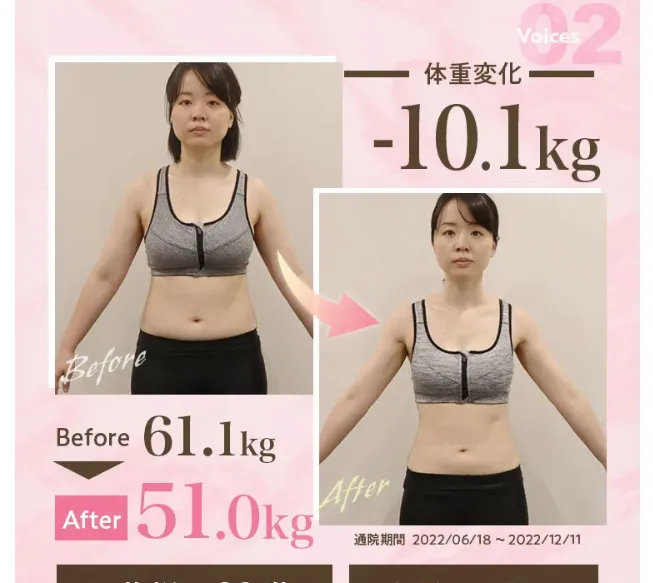 ディオクリニックの医療ダイエット症例