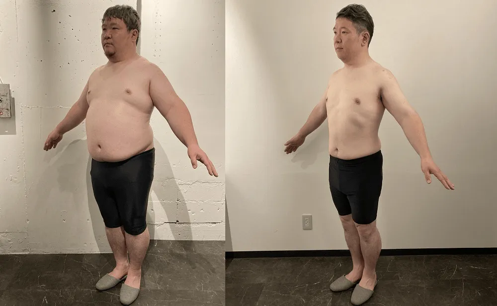 ディオクリニック無料ダイエットモニターの症例