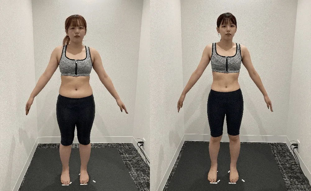 ディオクリニック無料ダイエットモニターの症例