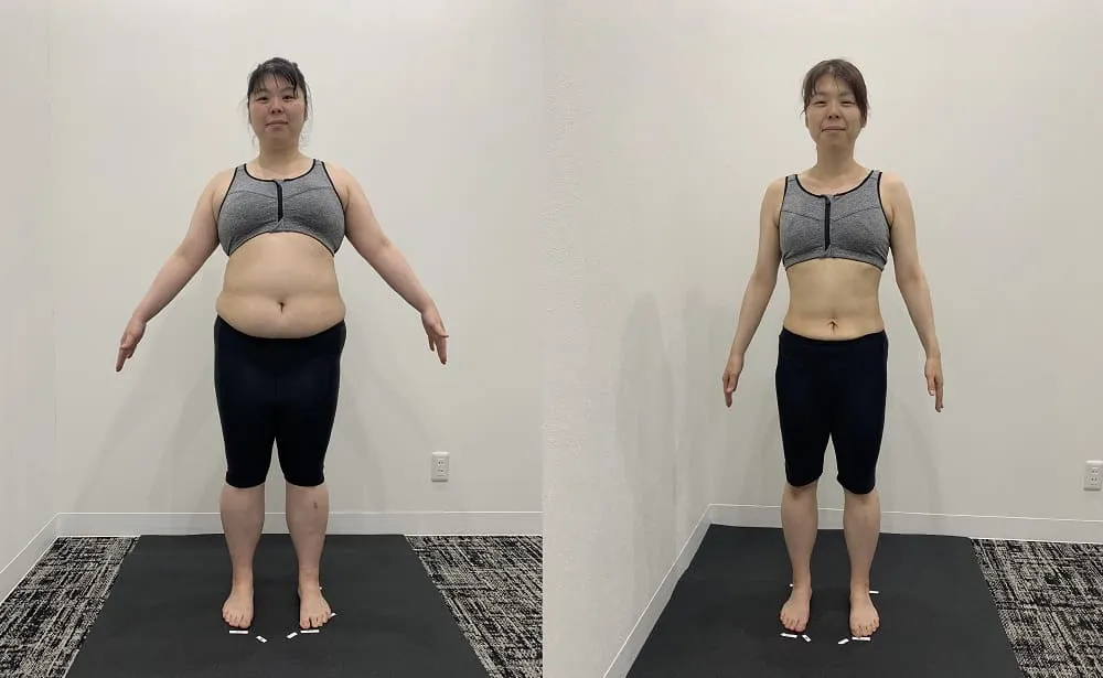ディオクリニックの医療ダイエットの症例