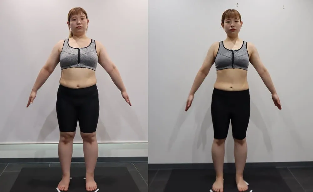 ディオクリニックの医療ダイエットの症例