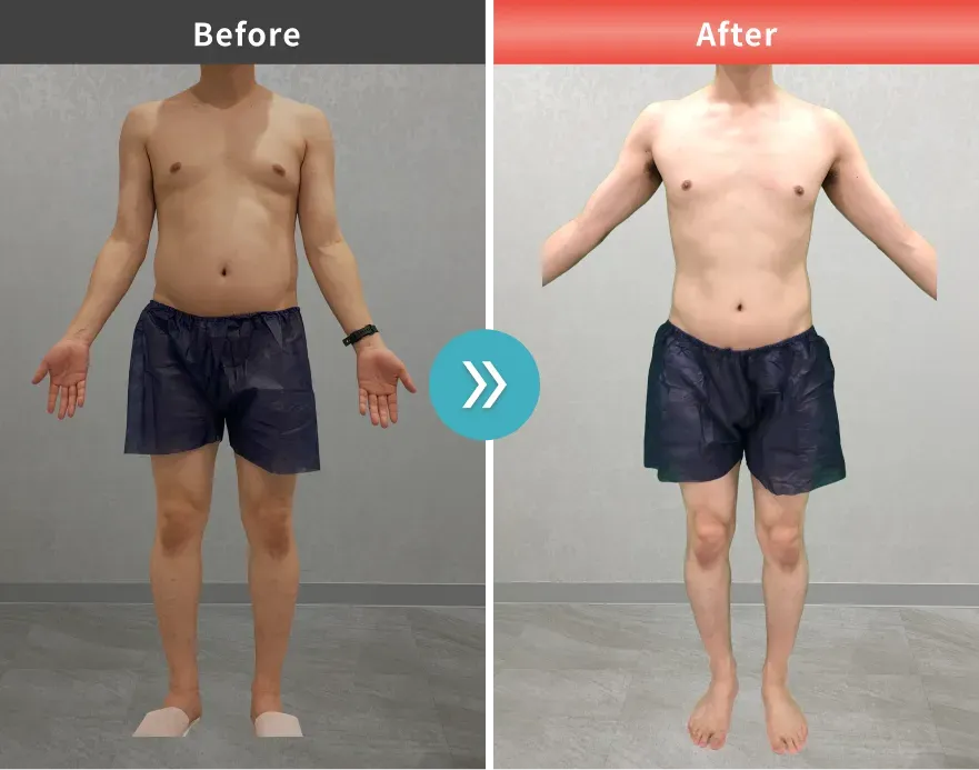 URARAクリニックの医療ダイエットの症例