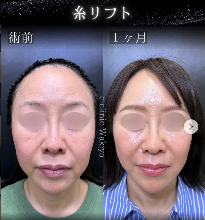 eクリニック脇谷雄一朗医師の症例1