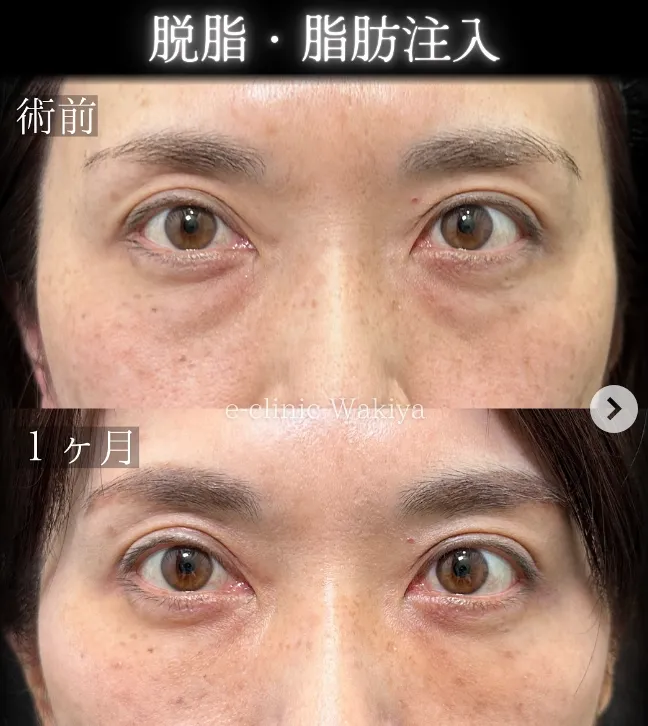 eクリニック脇谷雄一朗医師の症例2