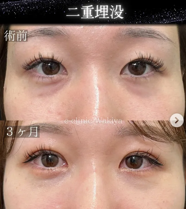 eクリニック脇谷雄一朗医師の症例3