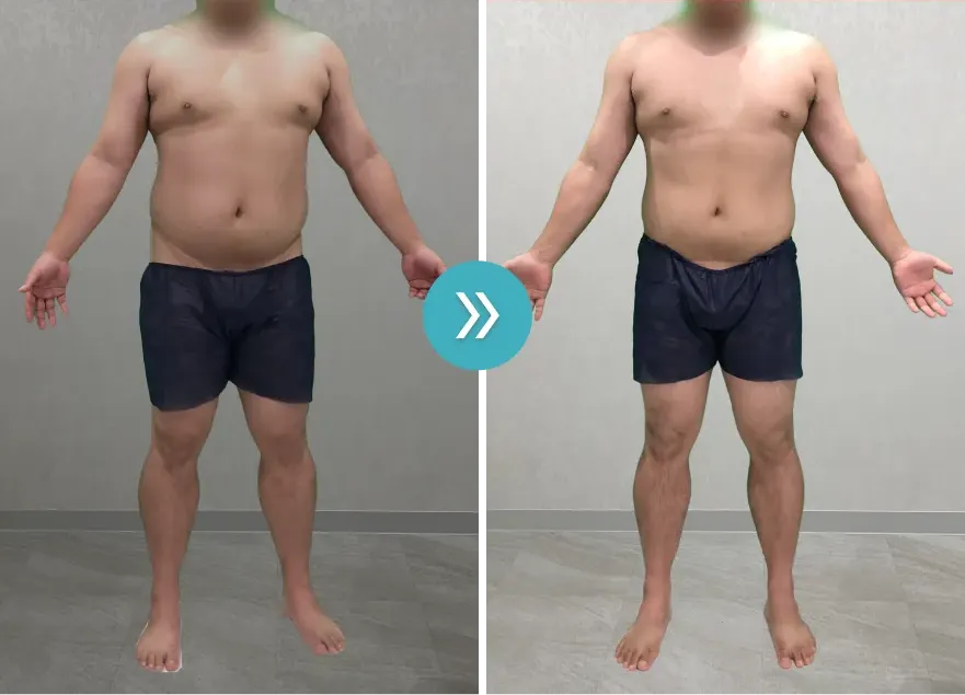 URARAクリニック医療ダイエットモニターの症例