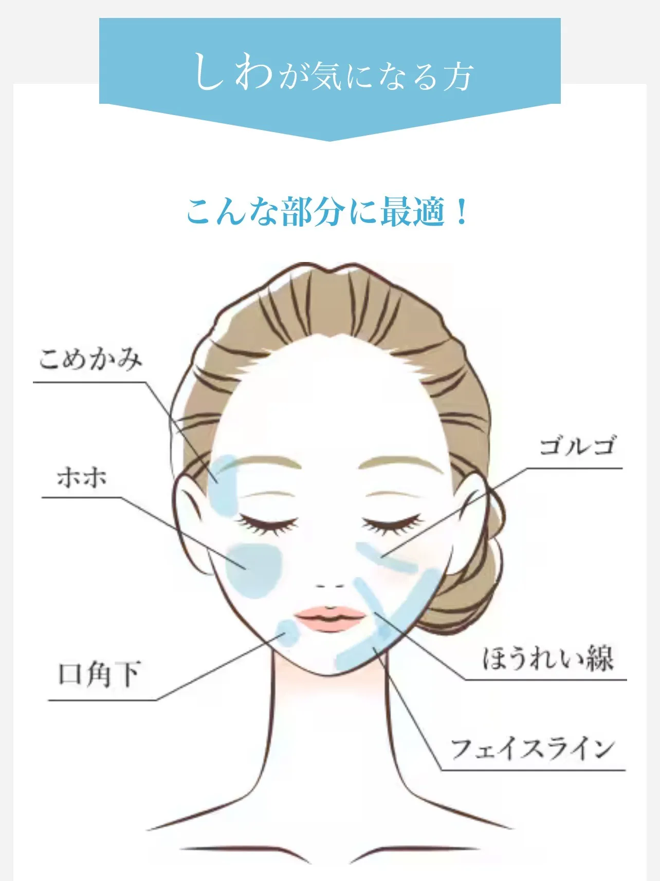 湘南美容クリニックのヒアルロン酸注入の対応可能箇所