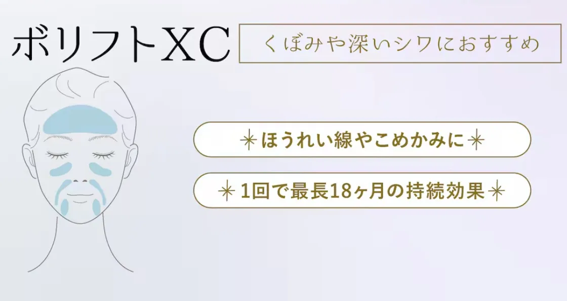 ヒアルロン酸:ボリフトXCの効果