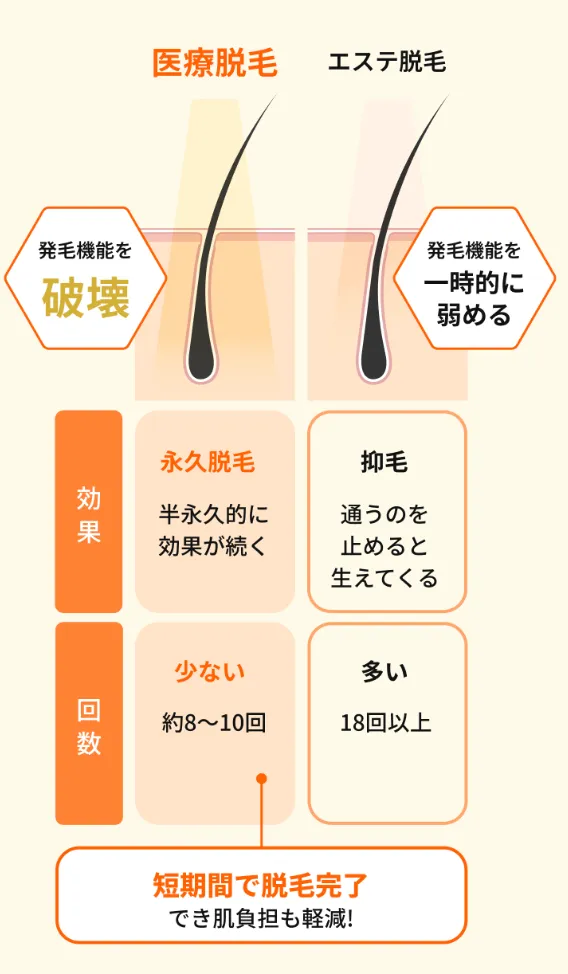 練馬で医療脱毛がおすすめのクリニックの施術内容