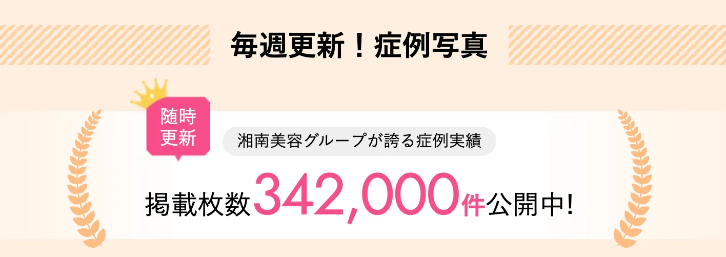 湘南美容クリニックの症例実績