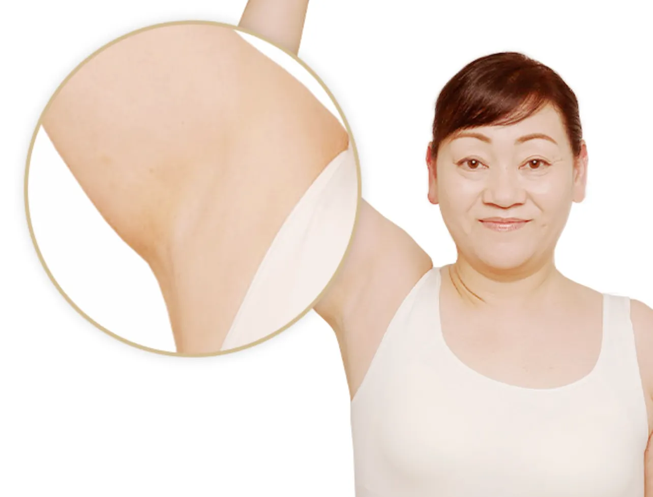 TBCの脱毛はツルスベ肌になれるという画像