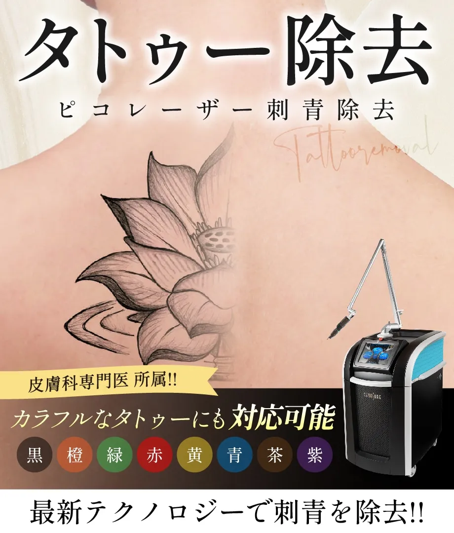 湘南美容クリニックのタトゥー除去(刺青除去)
