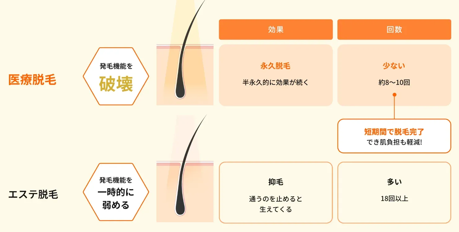 レジーナクリニック　医療脱毛　エステ脱毛　違い
