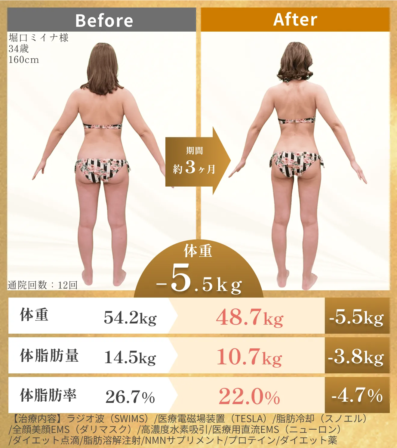 URARAクリニックモニターの堀口さんのビフォーアフター③