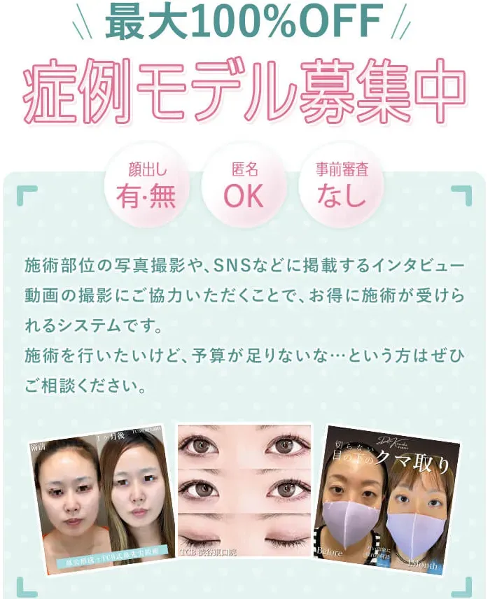 TCBの二重整形　症例モデル募集中最大100％OFF