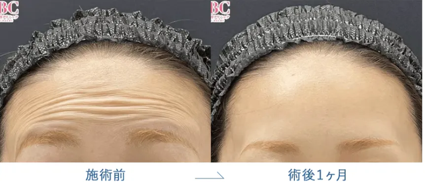 湘南美容クリニック(旧:湘南美容外科)の症例写真