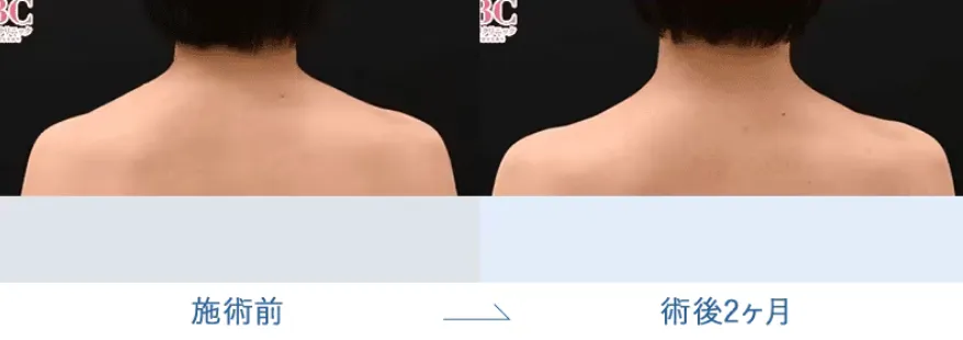 湘南美容クリニック(旧:湘南美容外科)の症例写真