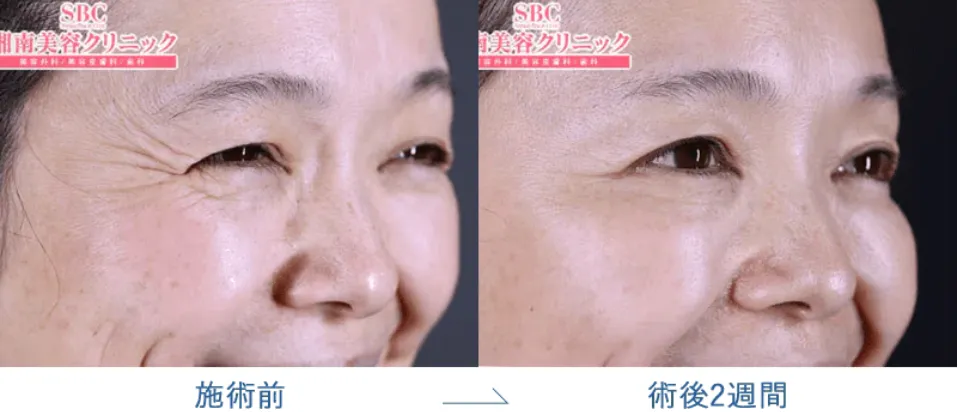 湘南美容クリニック(旧:湘南美容外科)の症例写真