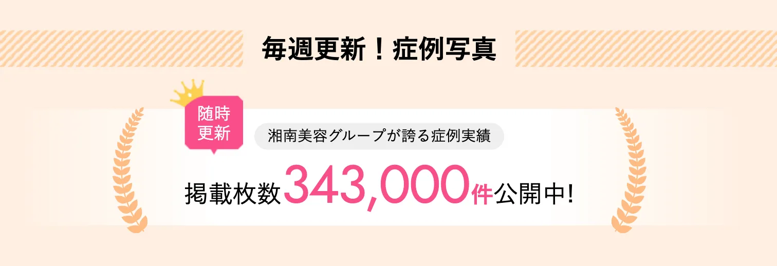 湘南美容クリニック(旧:湘南美容外科)の症例写真の実績