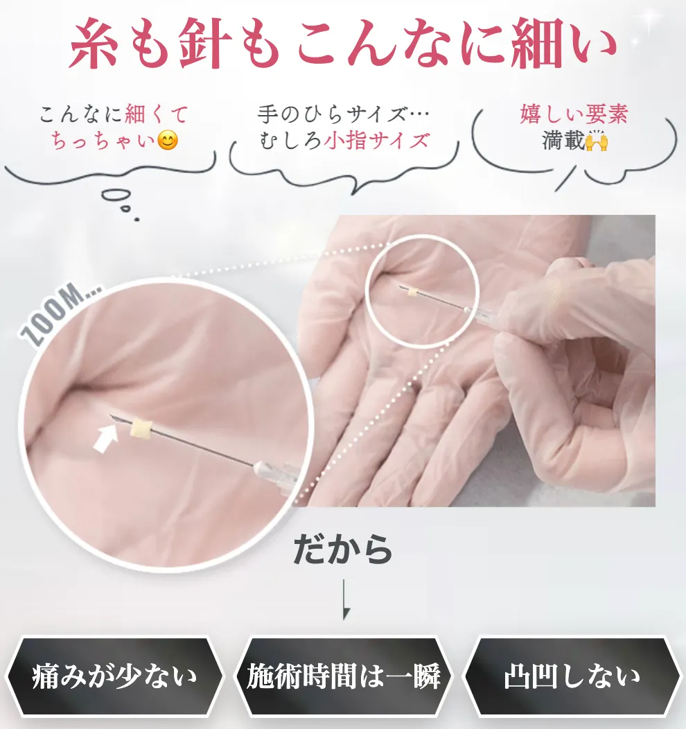 SBCトキシルスレッドの口コミ評判 トキシルスレッドの糸・針