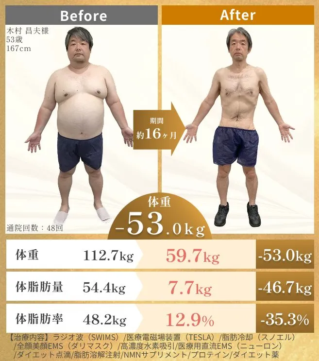 URARAクリニックモニターの木村さんのビフォーアフター