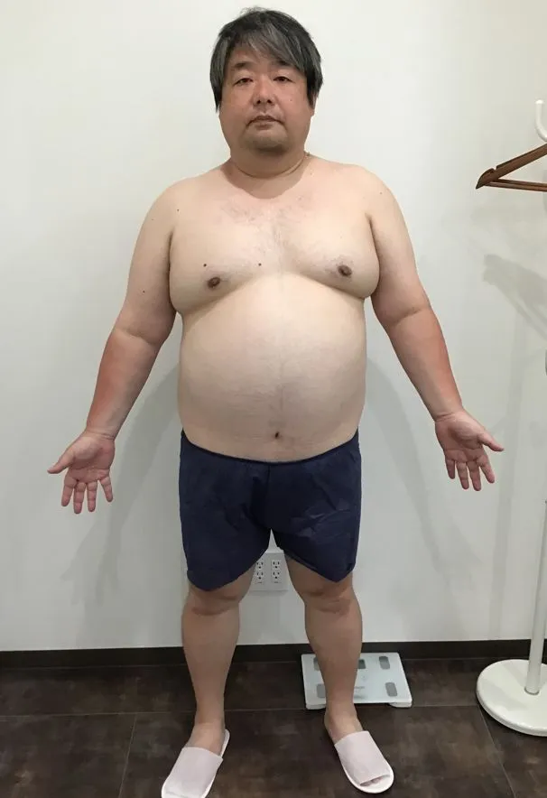 URARAクリニックモニターの木村さんの体