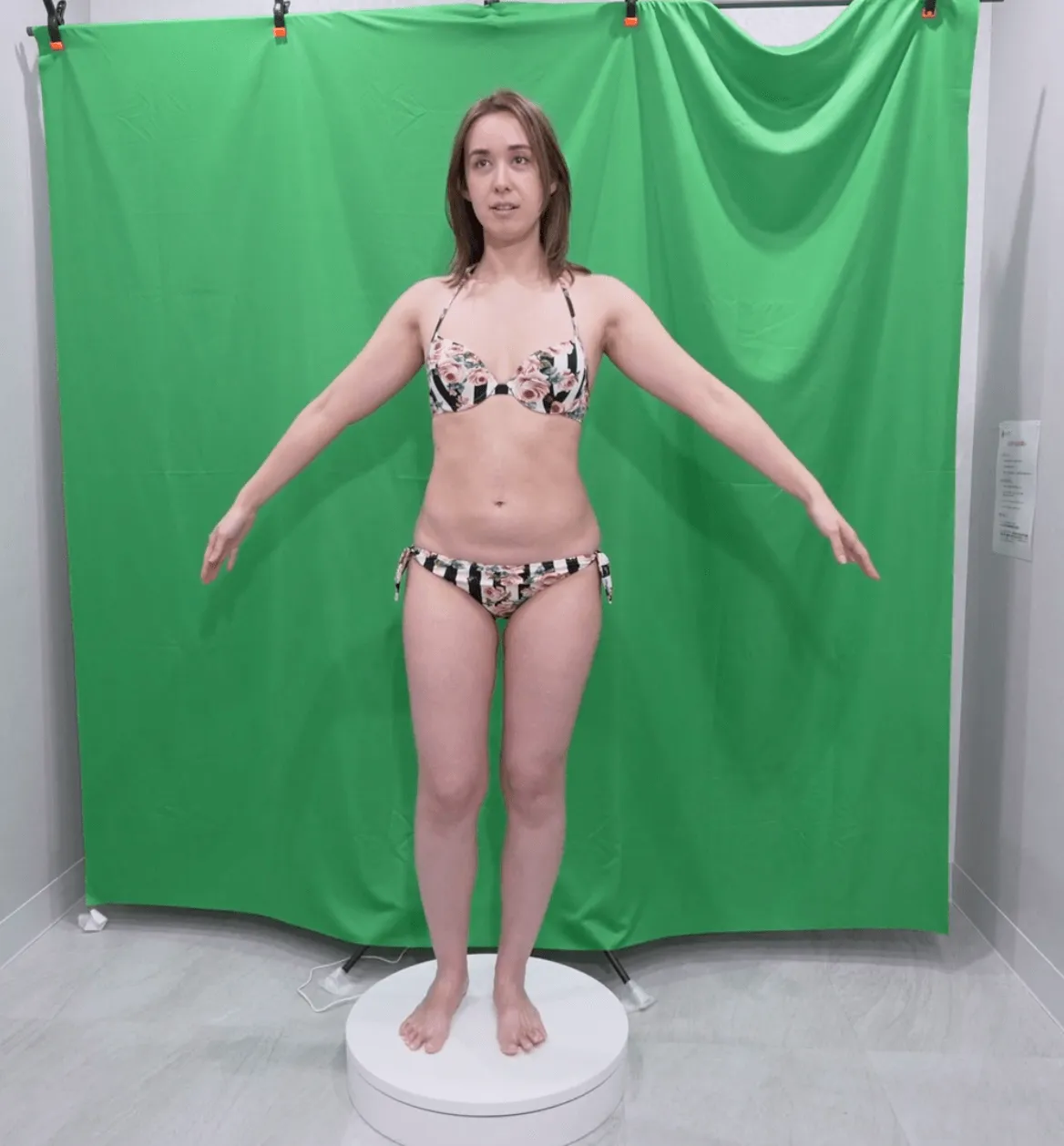 施術前画像(正面)