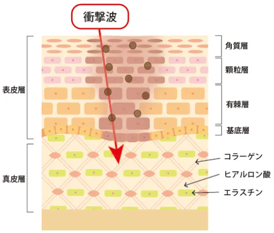 ビューティスクリニックのピコトーニングの口コミ評判　施術の仕組み