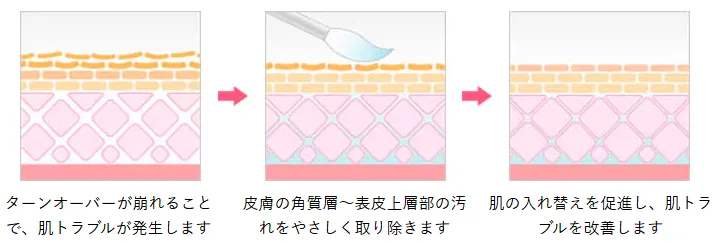 ケミカルピーリングが安いおすすめのクリニック 湘南美容クリニックの施術方法